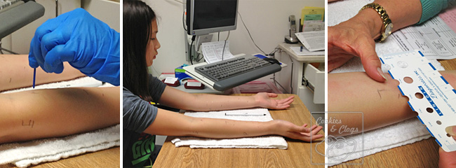 Allergy Testing on the Arm