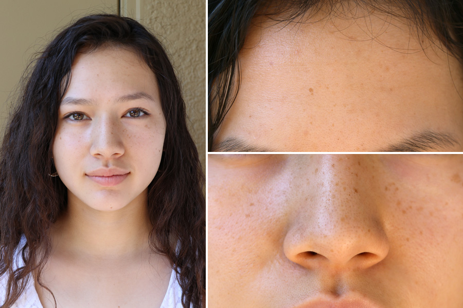 Custom teenage acne treatment w/ Curology - week 8, eye liner and mascara but no other makeup